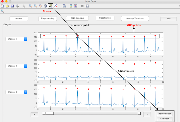 QRS2.png