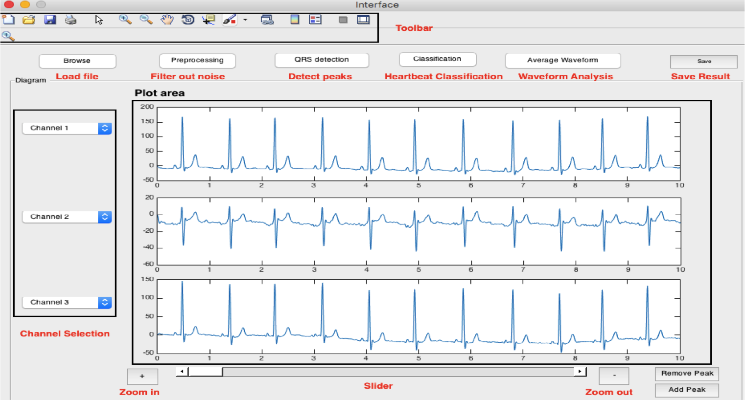 ECGinterface1.png