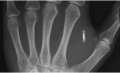 Thumbnail for version as of 23:00, 20 October 2016